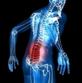 Osteochonds