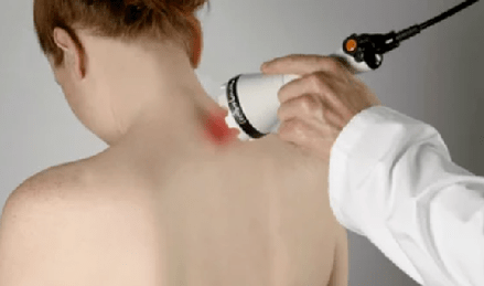 Behandlung vun cervical osteochondrosis mat Physiotherapie Methoden