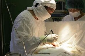 chirurgesch Behandlung vu Arthrosis vum Knéi Gelenk