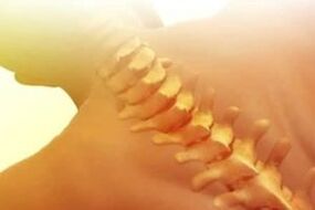 Osteochondrose wéi ze behandelen